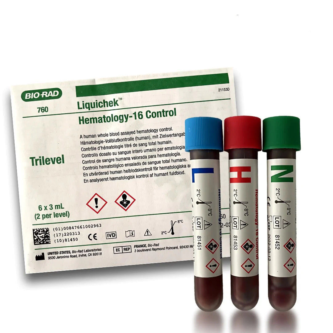 Control de hematología de tercera opinión